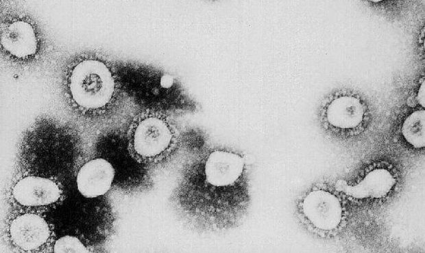 This undated handout photo from the Centers for Disease Control and Prevention (CDC) shows a micros...