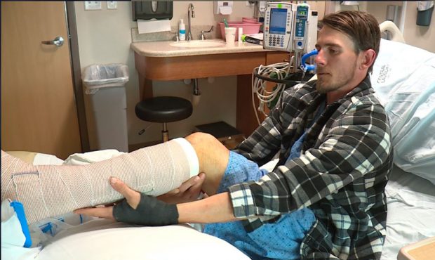 Jeremy Pottenger recovers from two broken legs at McKay-Dee Hospital in Ogden. (KSL TV)...