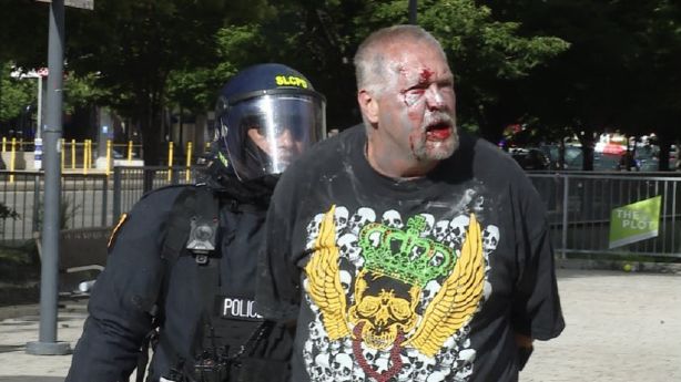 Police arrest a man after he allegedly threatened protesters with a bow and arrow on May 30, 2020, ...