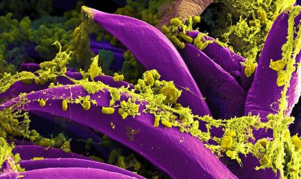 Purple-colored Yersinia pestis bacteria, the bacteria that causes the plague, seen on the spines of...