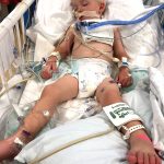 22-month-old Maverik Judd aspirated a dry pinto bean from a sensory play bin and was flown to Intermountain's Primary Children's Hospital where a surgeon removed the bean through a tracheotomy. (Photo Credit: Nikelle and Dalan Judd)