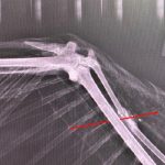 X-ray of the broken wing.(Utah Department of Wildlife Resources)