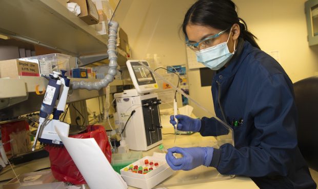 FILE: Medical laboratory scientist, Alicia Bui, runs a clinical test in the Immunology lab at UW Me...