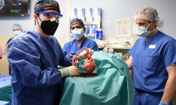 Surgeons show the genetically modified pig heart that was transplanted into a 57-year-old patient w...