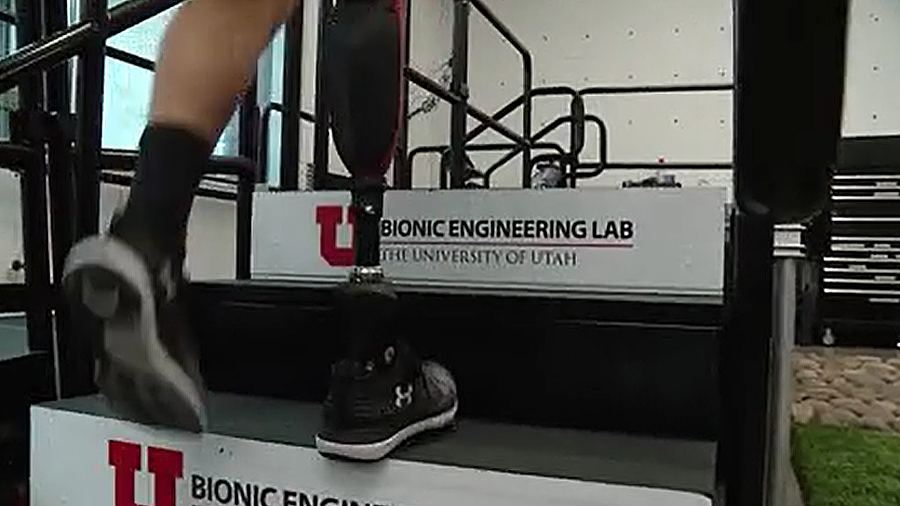 The Utah Bionic Leg it uses motors, processors, and advanced artificial intelligence to give ampute...