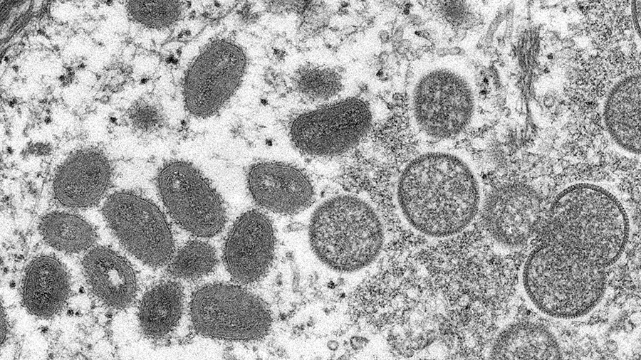 An electron microscopic (EM) image shows mature, oval-shaped monkeypox virus particles as well as c...