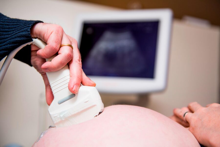 Illustration picture shows a doctor doing a ultrasound examination during a visit of a pregnant wom...